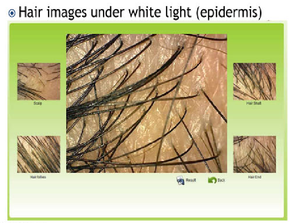 Da Hệ thống hình ảnh da Máy quét tóc phân tích nhà Máy Giá bán - Product Image 6