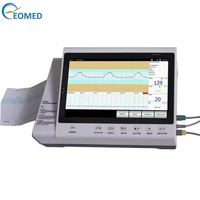 Monitor Fetal para Perros, para Mujeres Embarazadas y Cachorros, Pantalla de 10.2 Pulgadas, Sistema de Cardiotocógrafo Digital, Impresora Térmica de Alta Resolución FM30
