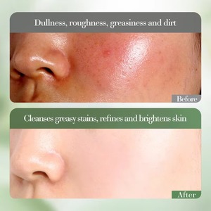 Crema Limpiadora Facial <span class=keywords><strong>de</strong></span> Kiwi, Antiarrugas, Hidratante, Control <span class=keywords><strong>de</strong></span> Grasa, Aminoácidos, Vitamina C, Blanqueadora - Product Image 6