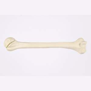 Kyrenmed cortical <span class=keywords><strong>humerus</strong></span> ขวา fractureed กับ <span class=keywords><strong>proximal</strong></span> <span class=keywords><strong>humerus</strong></span> <span class=keywords><strong>fracture</strong></span> สำหรับการประชุมเชิงปฏิบัติการการตัดเจาะ - Product Image 2