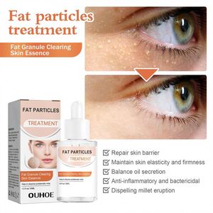 OUHOE - Esencia Facial de 30 ml para Eliminar Grasa y Granos, Tratamiento para Erupciones Cutáneas, Papules y Pústulas, Suero Facial - Product Image 3