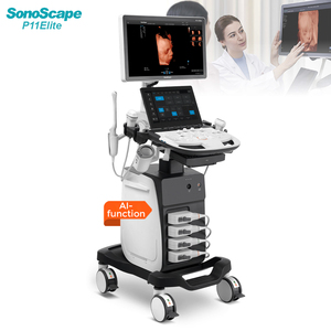 Appareil d'échographie Doppler couleur Sonoscape P11Elite 4D/5D avec fonction IA, chariot, pour les veines, le bébé, l'abdomen - Product Image 1