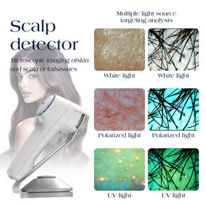 Máquina Analizadora de Piel y Cabello 2 en 1 Profesional con IA Inteligente para Detección de Cuero Cabelludo y Piel en 19 Idiomas - Product Image 4