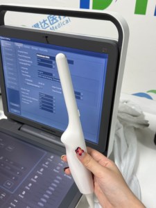 Ecógrafo Portátil Sonoscape S9 Tipo Laptop con Doppler Color para Diagnóstico Abdominal, Cardíaco, Obstétrico/Ginecológico - Product Image 6