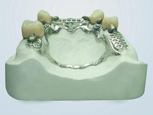 มินิแบบพกพา100วัตต์เลเซอร์เชื่อมเครื่องประดับเลเซอร์จุดเครื่องเชื่อมสำหรับความแม่นยำเชื่อมทำ - Product Image 3