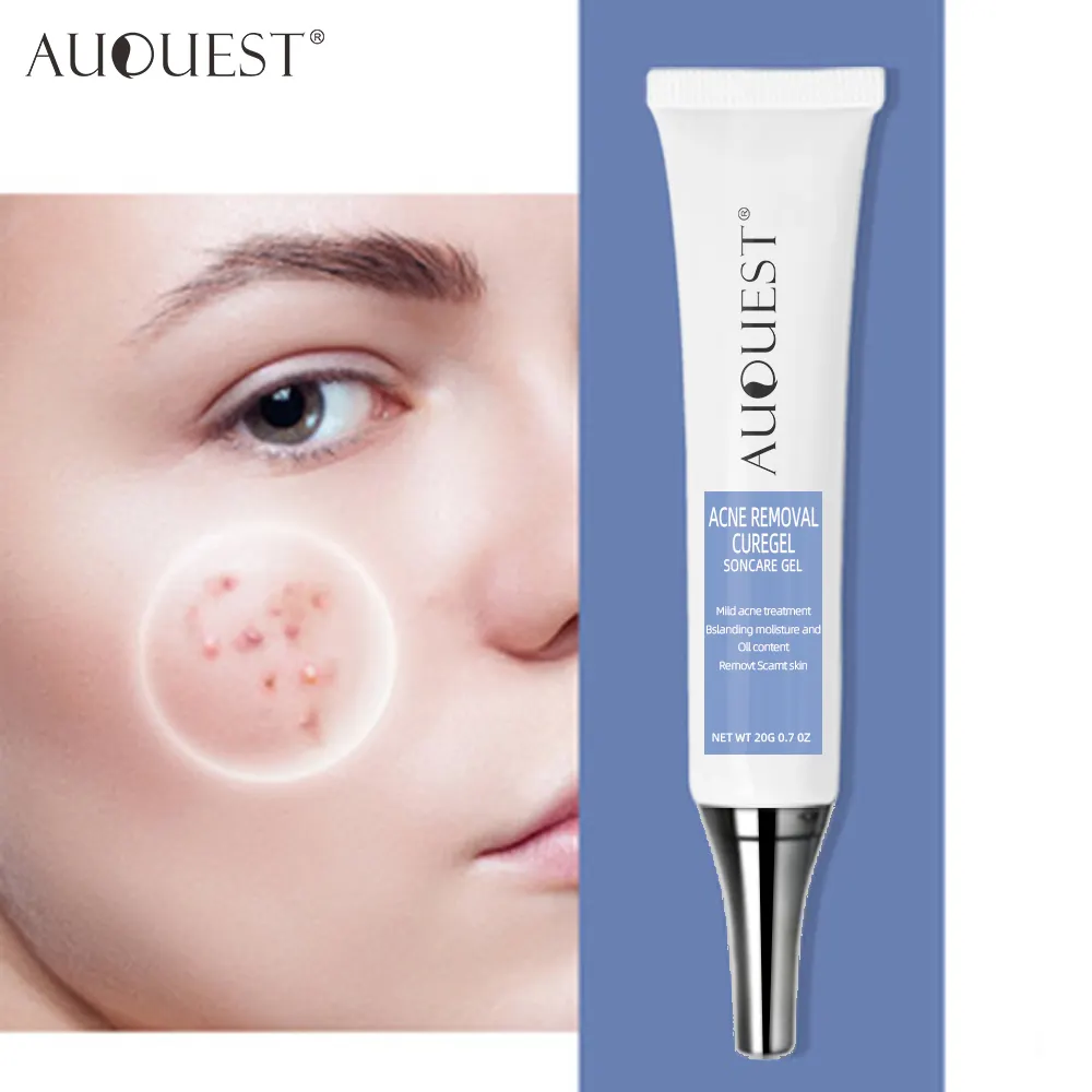 AuQuest Acne Removal Gel Anti Acne Cream Anti-inflammatory detoxification Acne Scar Care Product