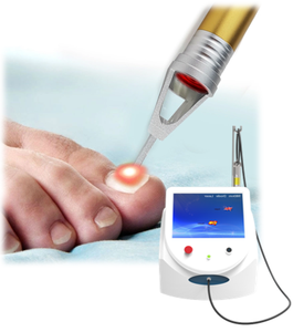 Podiatre professionnel utiliser 980nm Diode Laser Machine d'élimination <span class=keywords><strong>des</strong></span> champignons <span class=keywords><strong>des</strong></span> <span class=keywords><strong>ongles</strong></span> 30W onychomycose Portable prise US/EU <span class=keywords><strong>pour</strong></span> un usage domestique - Product Image 1