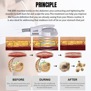 2025 Neuheiten EMS 2-Handstück Muskelstimulator Körperkonturierungsgerät EMS Körperformungsgerät - Product Image 3