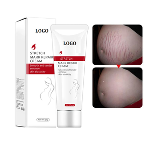 Sửa chữa Làm giảm vết rạn da cho chất béo điều trị mang thai tẩy xóa bỏng sẹo mụn làm trắng kem cho da rejuvanating Kem - Product Image 4