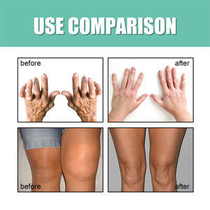 EELHOE scapulohumeral periarthritis ग्रीवा <span class=keywords><strong>spondylopathy</strong></span> arthralgia दर्द से राहत संयुक्त हड्डी गहन एकाग्रता क्रीम - Product Image 5