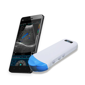 Venta caliente médica 192 elementos 5g ultrasonido inalámbrico Micro sonda convexa - Product Image 4