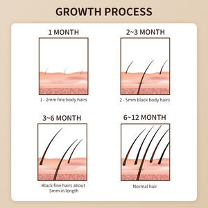 Champú Orgánico a Base de Hierbas Personalizado <span class=keywords><strong>para</strong></span> el Crecimiento del Cabello y Tratamiento Nutritivo Anticaída <span class=keywords><strong>para</strong></span> un Crecimiento Rápido, <span class=keywords><strong>para</strong></span> Hombres y Mujeres, OEM - Product Image 5