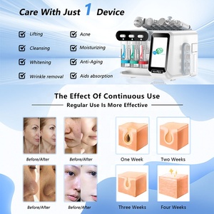 Fournitures d'esthéticienne NewFace, appareil Hydra Beauty, appareil de soin du visage, soin de la peau, oxygène facial portable, machine à bulles 7 en 1 - Product Image 2