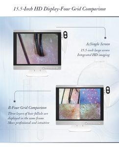 เครื่องวิเคราะห์ผิวพกพาขายดี กล้องตรวจหนังศีรษะแบบมือถือ HD 15.5 นิ้ว แรม 32GB สำหรับร้านเสริมสวยหรือใช้ในบ้าน - Product Image 3