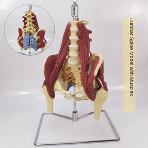 Thoát vị đĩa thắt lưng mô hình với cơ bắp và xương chậu bệnh lý cột sống demo cho các bác sĩ, bệnh nhân và các trường y tế - Product Image 2