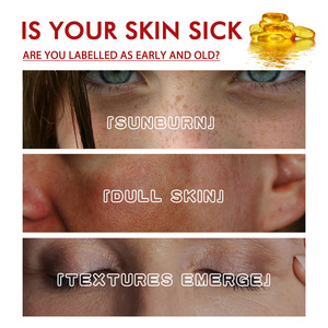 Black Spot Skin Color Repair Cover <span class=keywords><strong>Manchas</strong></span> oscuras Reposición de humedad Cuidado DE LA PIEL Spacer Fluid Foundation - Product Image 2