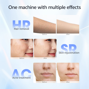 MLAY T14 IPL Depilação Depilador Malay Ice Cooling Laser Depilação Máquina Corpo Rosto Biquíni Dispositivo de depilação indolor 36w - Product Image 4