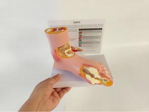 Modè<span class=keywords><strong>le</strong></span> de pied pathologique en PVC de marque Yulin pour la communication avec <span class=keywords><strong>les</strong></span> patients, pour la goutte, <span class=keywords><strong>les</strong></span> complications, l'arthrite, l'articulation du pied <span class=keywords><strong>et</strong></span> de la cheville - Product Image 6