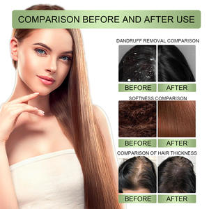 Aceite orgánico a base de hierbas para el cabello para la caspa y la pérdida de cabello, suero para el tratamiento del cuero cabelludo anticaída para un crecimiento rápido y esencia fortalecedora - Product Image 4