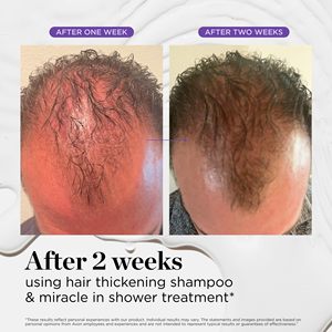 <span class=keywords><strong>Oplus</strong></span> OEM Vente en gros 100% Huile essentielle de romarin biologique à base de plantes naturelles pour le soin du cuir chevelu, sérum pour la croissance des cheveux, étiquette privée - Product Image 6