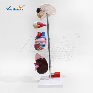 Modèle d'hypertension artérielle : un modèle comparative des vaisseaux sanguins normaux et malades ; un outil pédagogique médical. - Product Image 3