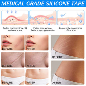 ALIVER 1.8X120 ''rouleau peau réparatrice brûlure chirurgicale cicatrice patchs Silicone cicatrice Gel feuilles d'enlèvement - Product Image 5