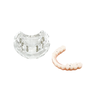 Modelos Dentales de Resina a Precio de Fábrica, Modelos de Implantes Dentales Maxilares y Dentaduras Postizas Reutilizables para Entrenamiento y Uso Educativo - Product Image 4