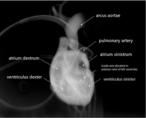 Simulateur <span class=keywords><strong>de</strong></span> formation en intervention coronaire percutée avec cœur battant pour <span class=keywords><strong>la</strong></span> formation aux procédures interventionnelles cardiovasculaires - Product Image 2
