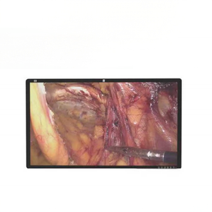 Moniteur endoscopique médical 4K HD de nouvelle conception pour chirurgie vétérinaire à prix avantageux - Product Image 2