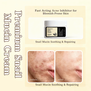 ครีมบำรุงผิวหน้าสารสกัดเมือกหอยทาก ช่วยเติมความชุ่มชื้น <span class=keywords><strong>ลด</strong></span>เลือนริ้วรอย <span class=keywords><strong>รอย</strong></span>สิว ฟื้นฟูผิว <span class=keywords><strong>ลด</strong></span><span class=keywords><strong>รอย</strong></span><span class=keywords><strong>แดง</strong></span> กระชับรูขุมขน ผลิตภัณฑ์บำรุงผิวจากเกาหลี - Product Image 3