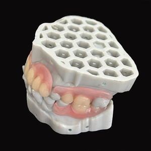 Superiore e inferiore struttura in metallo con protesi acrilica Base parziale flessibile cina laboratorio dentale prezzo - Product Image 4
