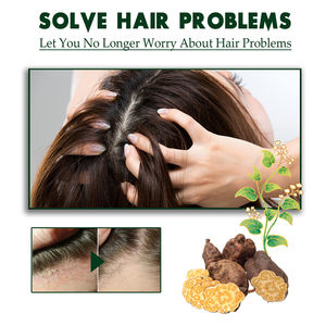 South Moon tinea capitis champú anti pruriginoso para el cabello dermatitis seborreica <span class=keywords><strong>psoriasis</strong></span> picazón aliviar la caspa champú Eliminador - Product Image 5