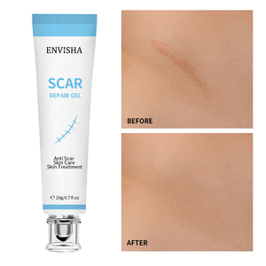 Hot Sale Huidverzorging Reparatie Effectieve Acne Chirurgie Litteken Verwijderen Crème Organische Litteken Verwijderen Gel Litteken Verwijdering