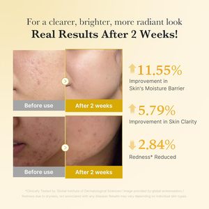 Sérum Facial Coreano de Urze e Cúrcuma 30ml Antienvelhecimento e Antirrugas, Líquido com Ácido Kójico e Vitamina C - Product Image 5