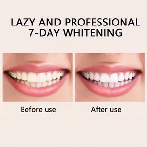 Cepillo de Dientes Eléctrico Ultrasónico Recargable por USB, Resistente al Agua IPX7, Personalizado OEM, Suave para Uso Doméstico - Product Image 6