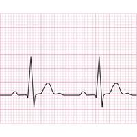 Rouleaux de papier thermique pour électrocardiogramme (ECG) de 63 mm x 30 m, vente en gros d'usine, pour appareils d'enregistrement médical