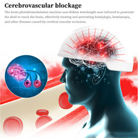 Casque de photobiomodulation infrarouge Suyzeko OEM Neuronic 810nm 1070nm pour l'amélioration de l'oxygénation cérébrale et l'hydrogénation, avec réglage 1-20000 Hz