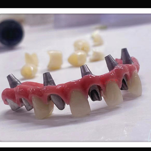 Implan gigi kustom Titanium <span class=keywords><strong>Abutment</strong></span> dengan Screwed Zirconia mahkota untuk latihan gigi En China <span class=keywords><strong>Dental</strong></span> Lab - Product Image 3