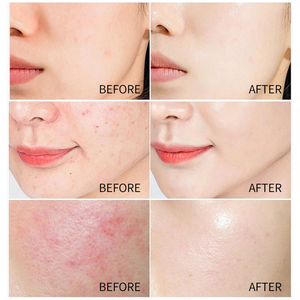 Esencia Iluminadora con Extracto de Arroz Orgánico Natural, Exfoliante Aclarante de Marca Privada, Libre de Crueldad Animal, Tónico Antiarrugas y Minimizador de Poros - Product Image 6