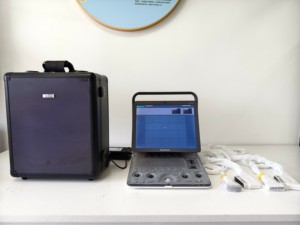 Ecógrafo Doppler Color Portátil Sonoscape S8expV con Elastografía 4D 3D para Animales, para Clínica Veterinaria - Product Image 4