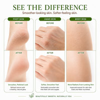 Lemon Lime Sugar Scrub Body Exfoliator Deep Cleansing Dead Skin Removal Moisturizing Spa Skin Care
