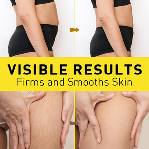 Crema Modellante Corpo Personalizzata, Rassodante per Pelle, Massaggio Brucia Grassi, Rassodante e Lifting per Glutei e Pancia, Ingredienti Naturali, Collagene - Product Image 4