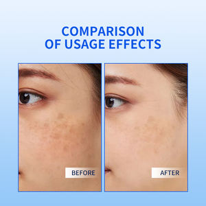 Kit de Noël OEM élimine la décoloration autour des yeux hydrate en profondeur élimine les cernes peau autour des yeux crème <span class=keywords><strong>anti</strong></span>-obscurité pour les yeux - Product Image 5