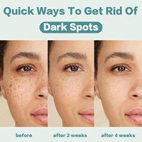 Prix usine meilleure crème pour éclaircir les Noirs charmante crème blanchissante visage beauté Melasma enlèvement