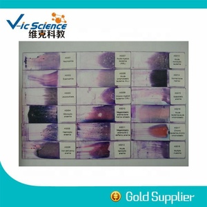 <strong>Microscope</strong> <strong>Prepared</strong> <strong>Slides</strong> Hematology <strong>Prepared</strong> <strong>Slides</strong> Blood Smear <strong>Prepared</strong> <strong>Slides</strong> - Product Image 6