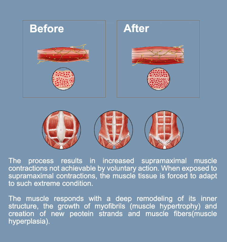High Power 4 Handles Ems Slimming Machine For Muscle Building