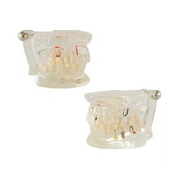 32 dientes mes completo implante enfermedad dientes modelo claro diseño implatn dientes estudio modelo dentsit uso patología dental modelo