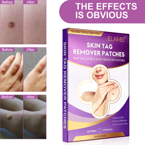 ELAIMEI Custom Logo <strong>Skin</strong> <strong>Tag</strong> <strong>Remover</strong> <strong>Patches</strong> 144pcs OEM Service Natural Herbal Acne &amp; Wart Removal Pain Free Fast Acting Factory - Product Image 2