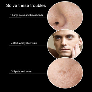 VENZEN Kit de Soin Visage Homme Cinq Pièces : Tonique, Essence, Lait Hydratant, Nettoyant Régulateur de Sébum, et Crème Rafraîchissante Multi-Effets - Product Image 6