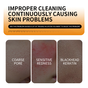 Tự Nhiên Hiệu Quả Kojic Axit Xà Phòng Cho Cơ Thể Mặt Làm Sáng Da Tẩy Tế Bào Chết Thanh Phát Sáng Da Tone Làm mờ Da Đốm Đốm Mụn Trứng Cá - Product Image 3